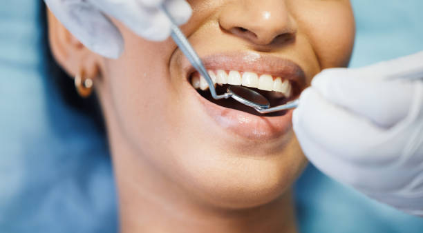 Best Same-Day Emergency Dentist in Iyanbito, NM